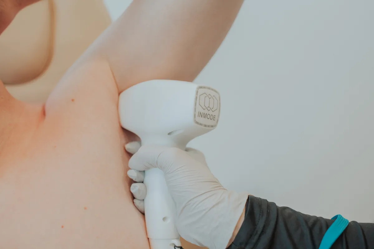 Laser Hair Removal in Eagle Mountain, Utah – What You Need to Know