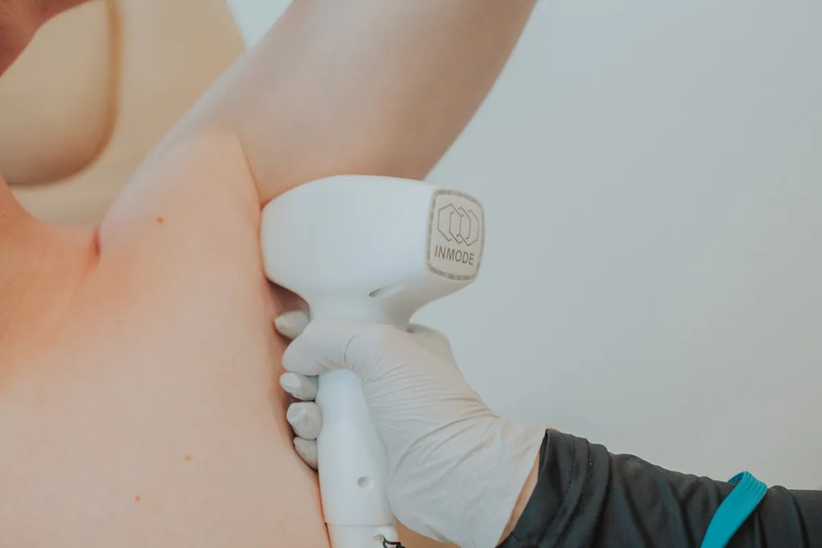 Laser Hair Removal in Eagle Mountain