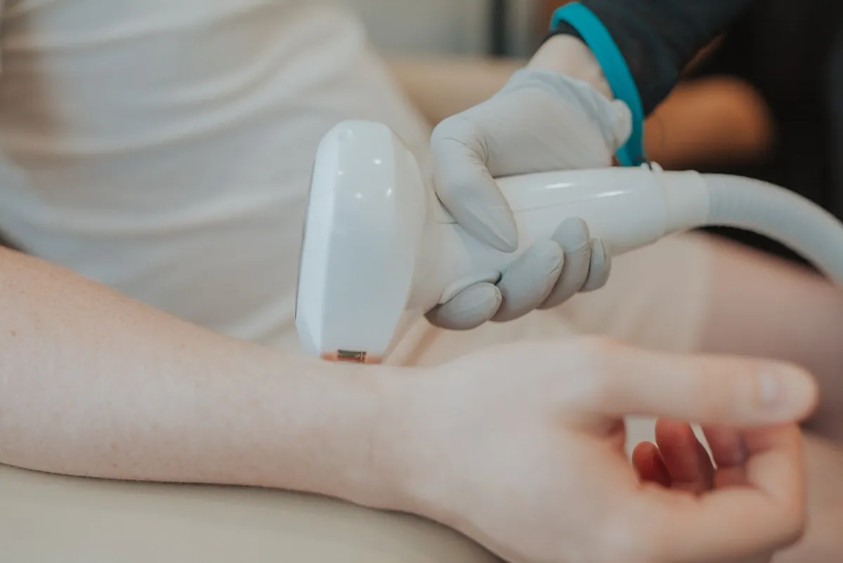 Reveal Radiant Skin with IPL Treatments in Eagle Mountain, Utah – Your Complete Guide