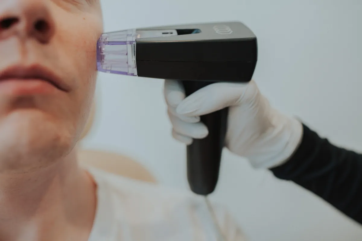 Skin Tightening on Morpheus8 in Eagle Mountain, Utah – What You Need to Know